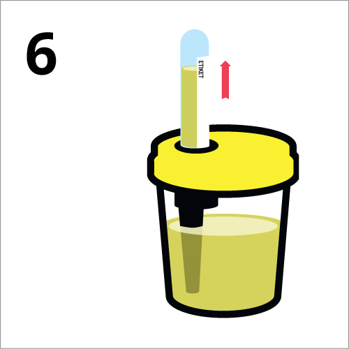 Afname-instructies urine onderzoek (6).png