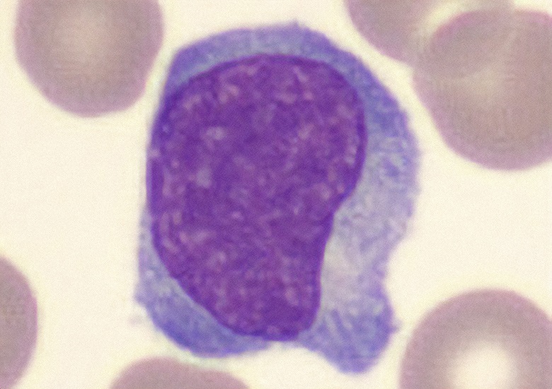 Lymfocytose